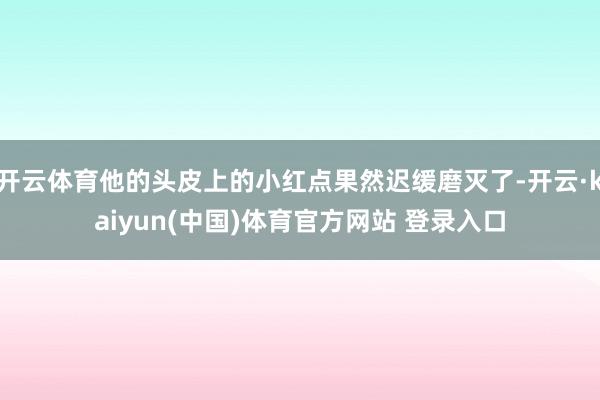 开云体育他的头皮上的小红点果然迟缓磨灭了-开云·kaiyun(中国)体育官方网站 登录入口